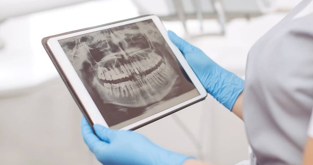 Dental Technology in Greenville, SC