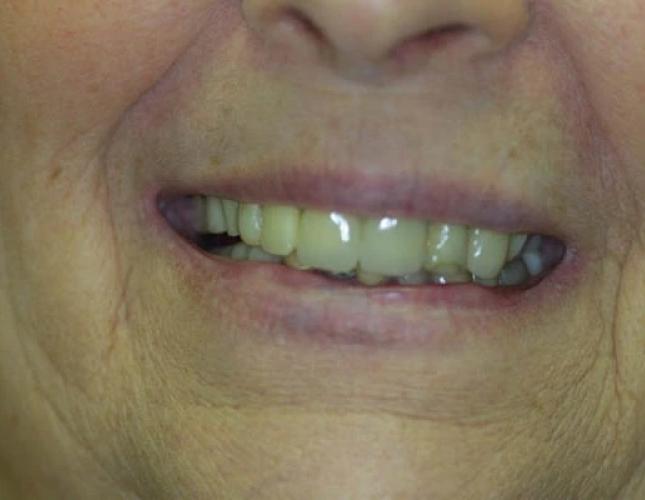 Case 12 before