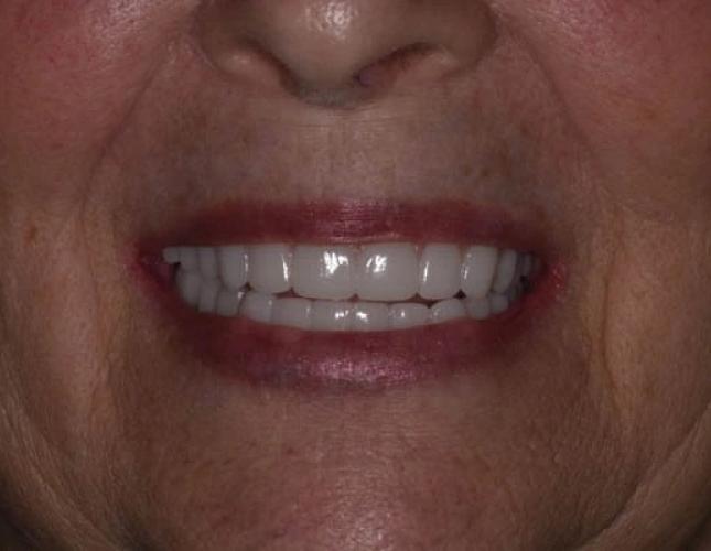 Case 12 after