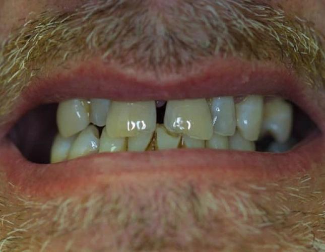 Case 10 before