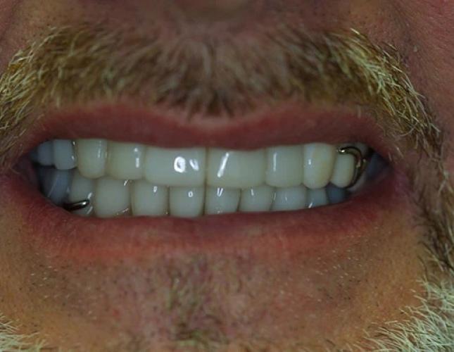 Case 10 after