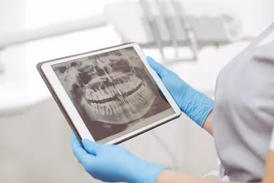 dentist reviewing a dental x-ray on a tablet