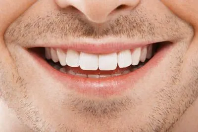 closeup of a Meyer Dentistry patient after dental crowns restored his smile